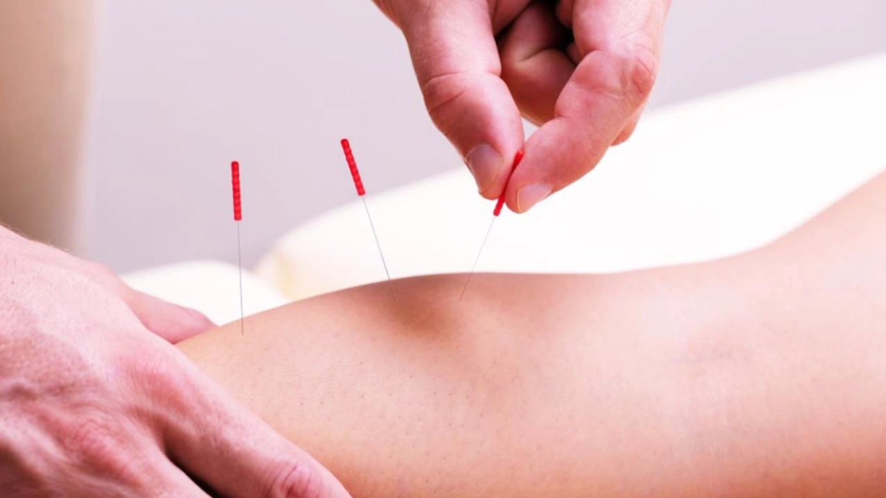 The Benefits of Acupuncture for Bladder Pain Relief